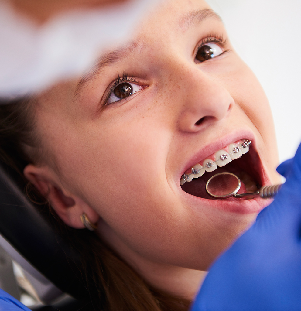 When is the Best Time for a Child’s First Orthodontic Evaluation?