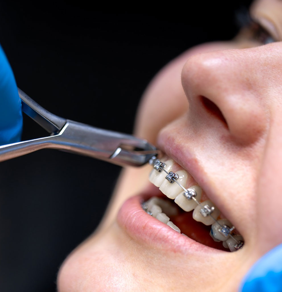 How Orthodontics Can Improve Your Smile, Health, and Quality of Life